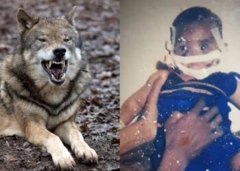 I hëngri ujku fytyrën kur ishte 5 muajsh, shikoni si duket sot në moshën 18 vjecare