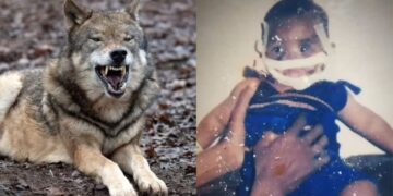 I hëngri ujku fytyrën kur ishte 5 muajsh, shikoni si duket sot në moshën 18 vjecare