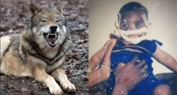 I hëngri ujku fytyrën kur ishte 5 muajsh, shikoni si duket sot në moshën 21 vjecare