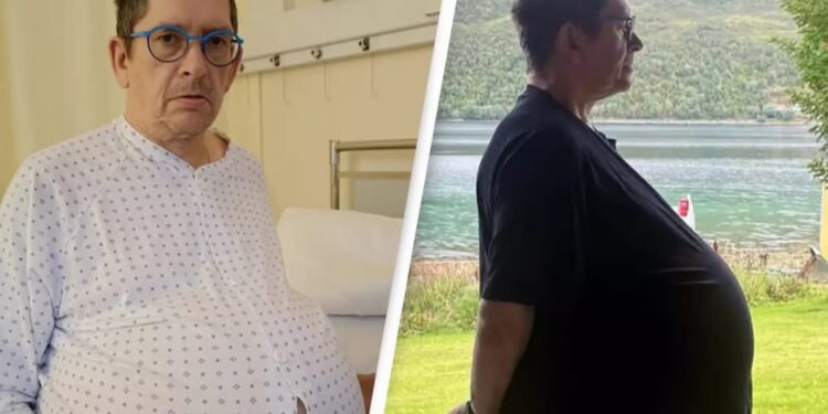 Mjekët i thonin se je mbipeshë, por barku i tij rritej çdo ditë, burri zbulon të vërtetën rrëqethëse..