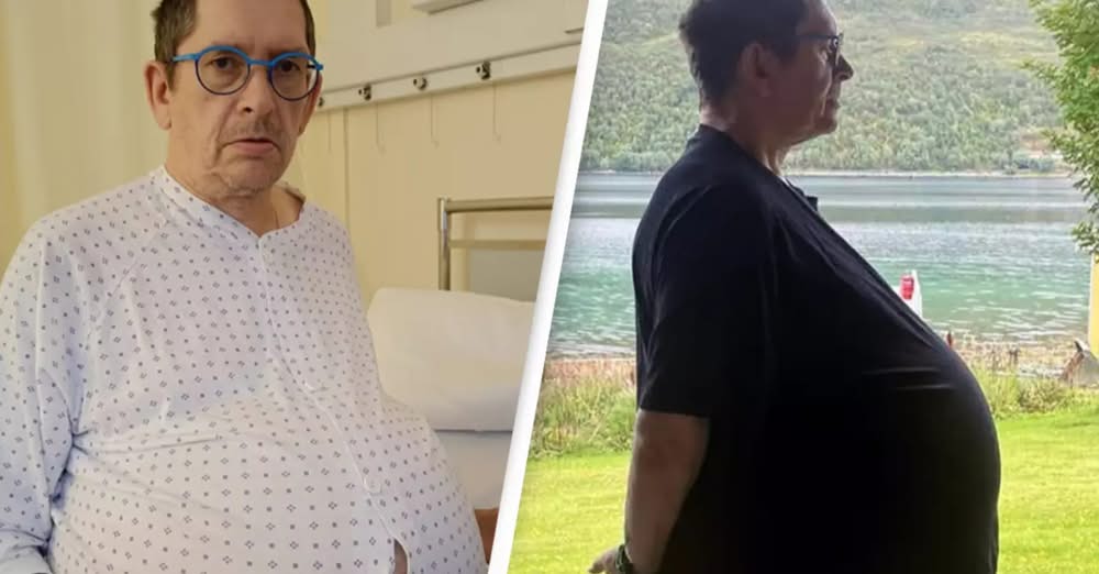 Mjekët i thonin se je mbipeshë, por barku i tij rritej çdo ditë, burri zbulon të vërtetën rrëqethëse..