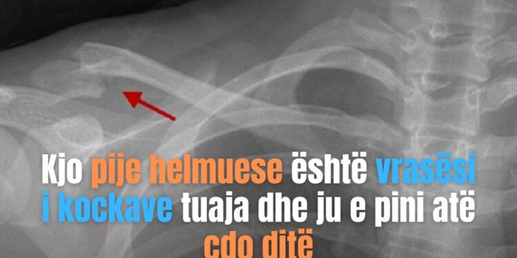 Kjo pije helmuese është vrasësi i kockave tuaja dhe ju e pini atë çdo ditë