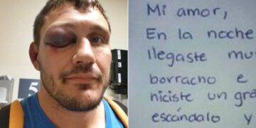 Zgjohet me sy të nxirë, burri shpërthen në lot kur sheh shënimin e gruas së tij