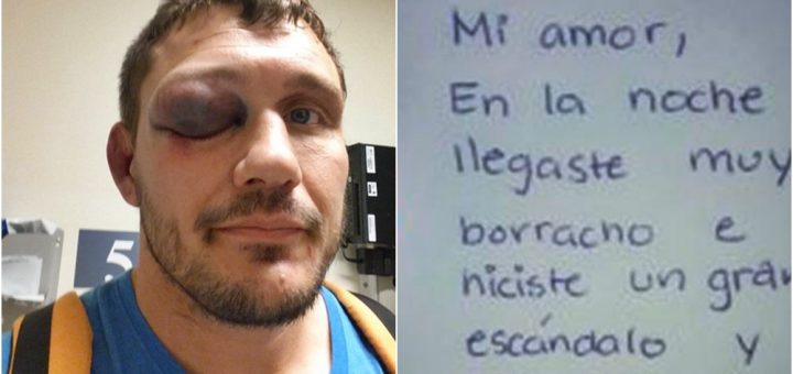 Zgjohet me sy të nxirë, burri shpërthen në lot kur sheh shënimin e gruas së tij