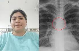 Mendonte se kollitej prej alergjisë, gruaja  zbulon të vërtetën tronditëse pasi përfundon në spital..