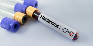 Hantavirusi ALARMON botën/ Deri në 8 javë në intubim dhe rikuperimi! Sa muaj vazhdojnë simptomat pas infektimit…