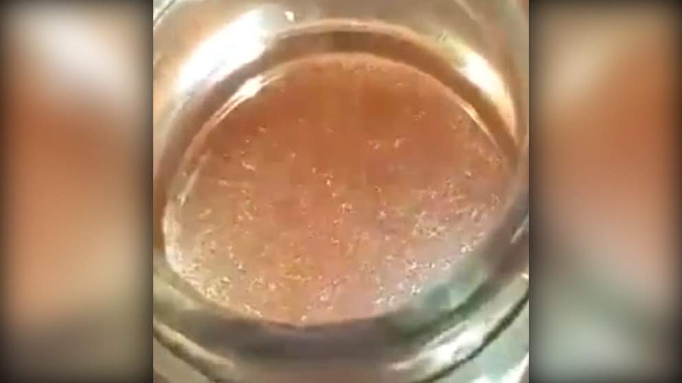 Skandal/ Uthull me krimba studentëve të Akademisë së Sigurisë që u helmuan..(Video)
