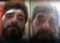 Dhunohet analisti Ilir Demalia