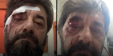 Dhunohet analisti Ilir Demalia