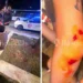 “Na rrahën në mes të sheshit”, turistët italianë denoncojnë të rinjtë në Tiranë, dhe publikojnë fotot: As policia nuk ndërhyri..